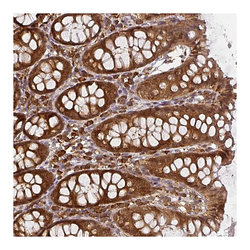 Atlas Antibodies Anti-PPP6R3 Antibody