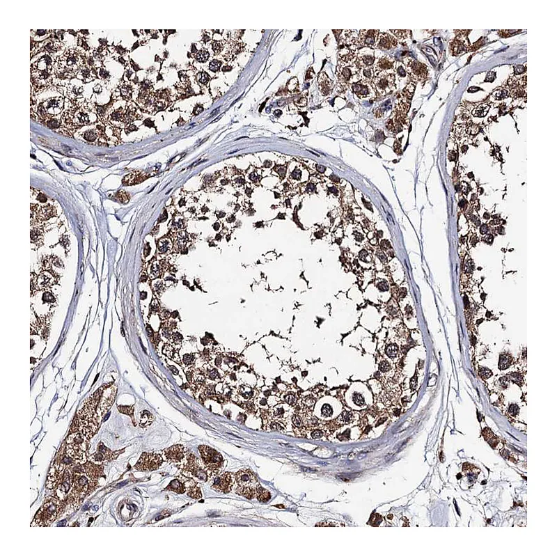 Atlas Antibodies Anti-PPTC7 Antibody