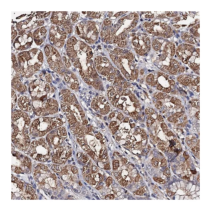 Atlas Antibodies Anti-PPTC7 Antibody