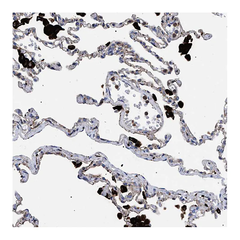 Atlas Antibodies Anti-PPT1 Antibody