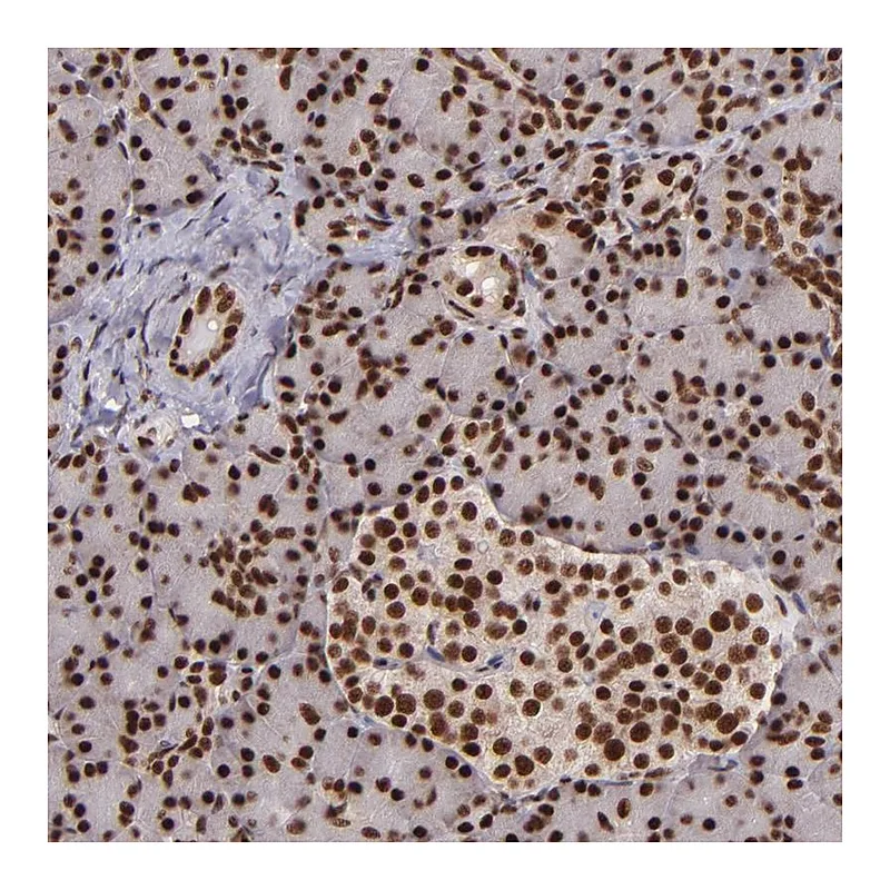 Atlas Antibodies Anti-PQBP1 Antibody