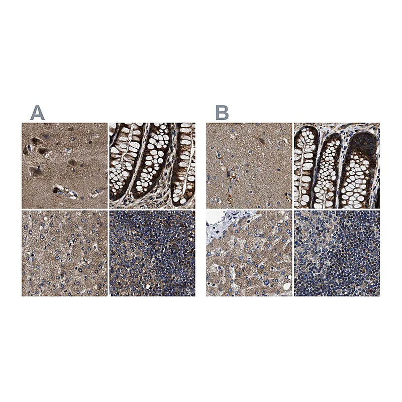 Atlas Antibodies Anti-PPWD1 Antibody