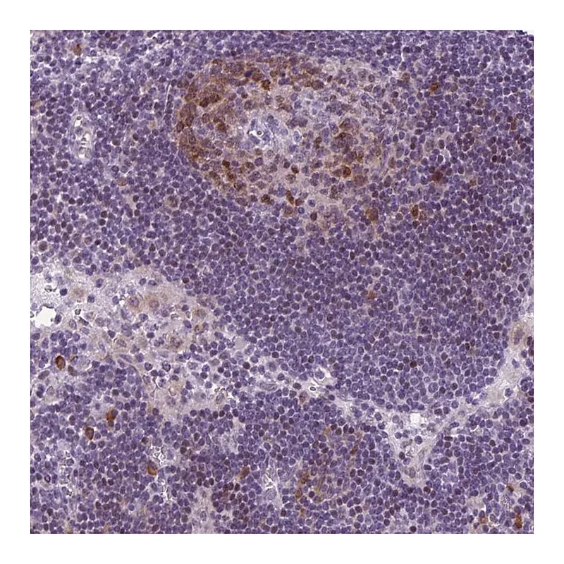 Atlas Antibodies Anti-PQLC1 Antibody