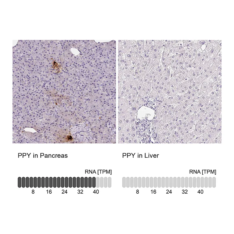 Atlas Antibodies Anti-PPY Antibody