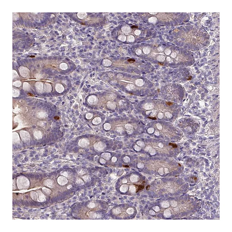 Atlas Antibodies Anti-PRADC1 Antibody