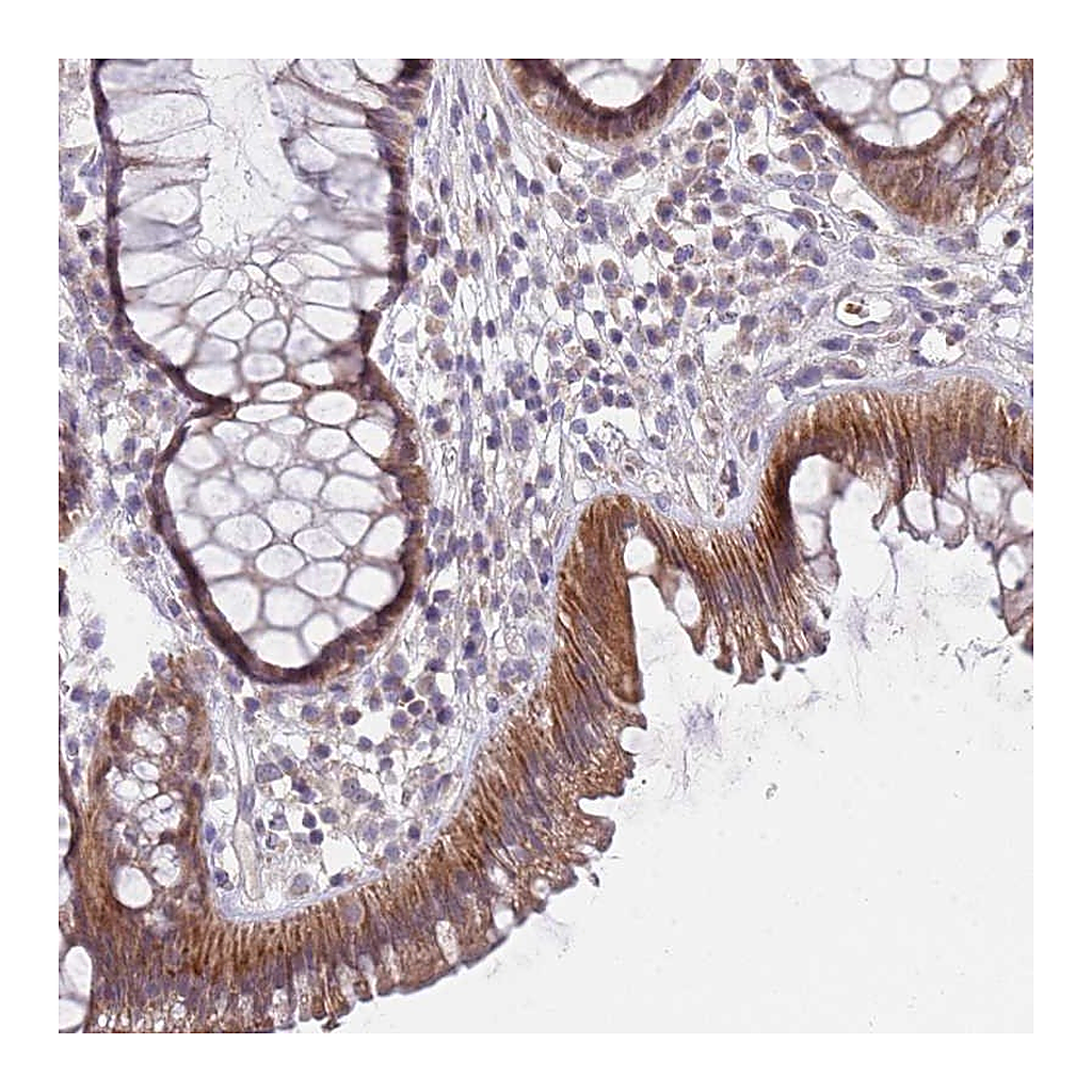 Atlas Antibodies Anti-PRAC1 Antibody