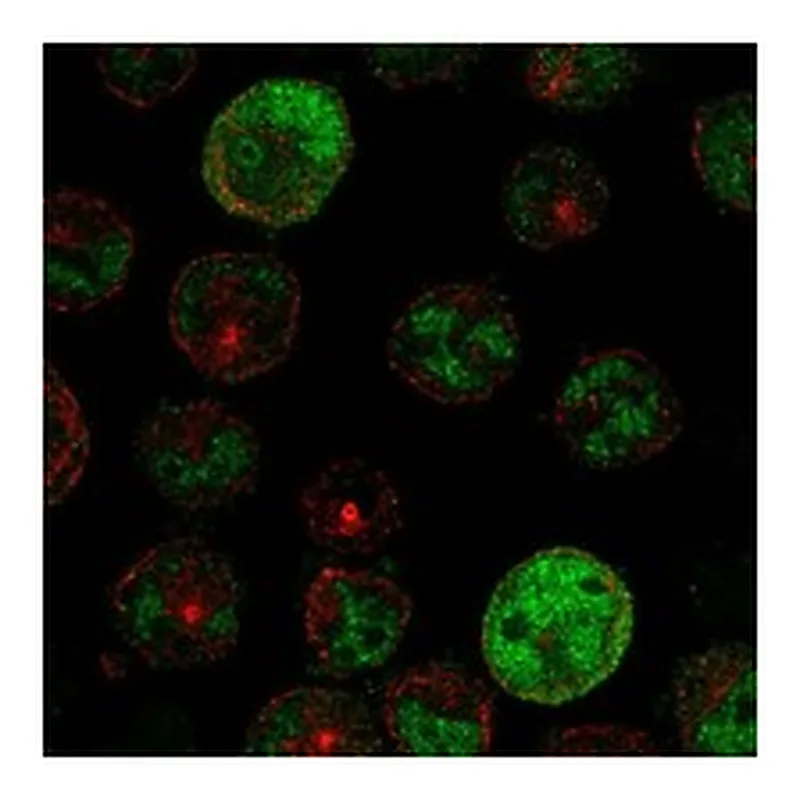Atlas Antibodies Anti-PRAME Antibody