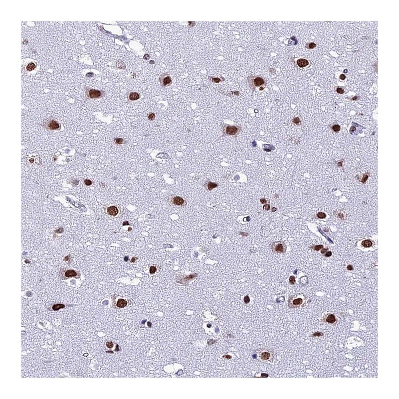 Atlas Antibodies Anti-PRAMEF12 Antibody