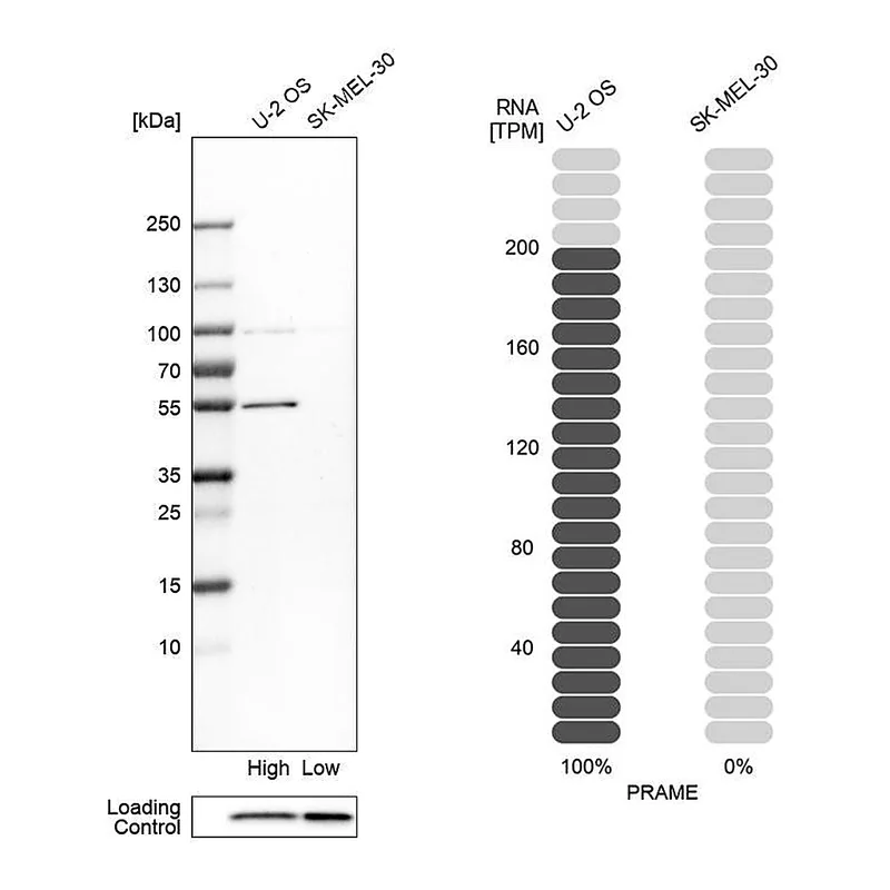 Atlas Antibodies Anti-PRAME Antibody