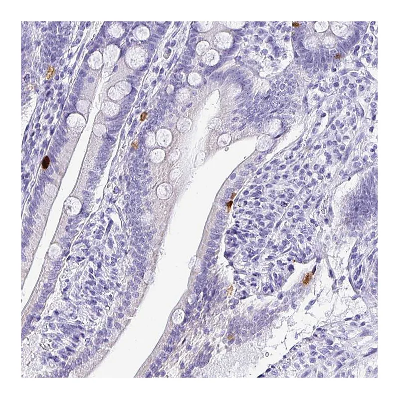 Atlas Antibodies Anti-PRAMEF19 Antibody