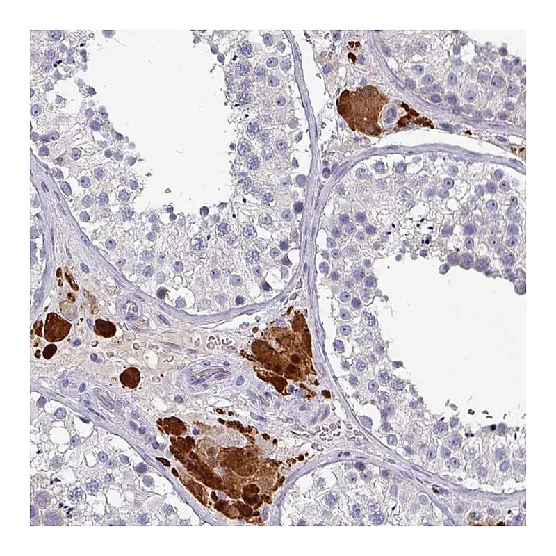 Atlas Antibodies Anti-PRAMEF7 Antibody