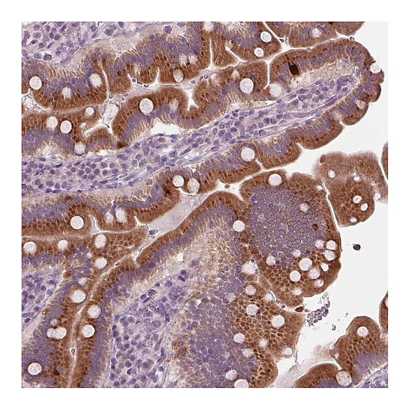 Atlas Antibodies Anti-PRAP1 Antibody