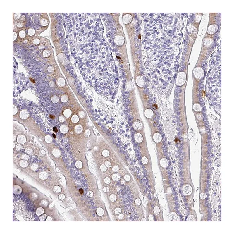 Atlas Antibodies Anti-PRAP1 Antibody