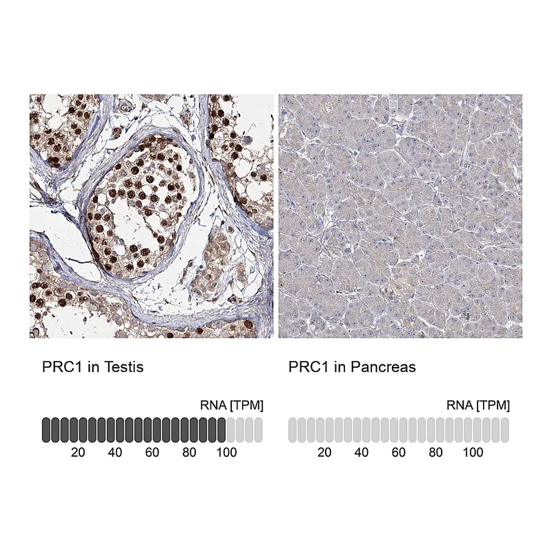 Atlas Antibodies Anti-PRC1 Antibody