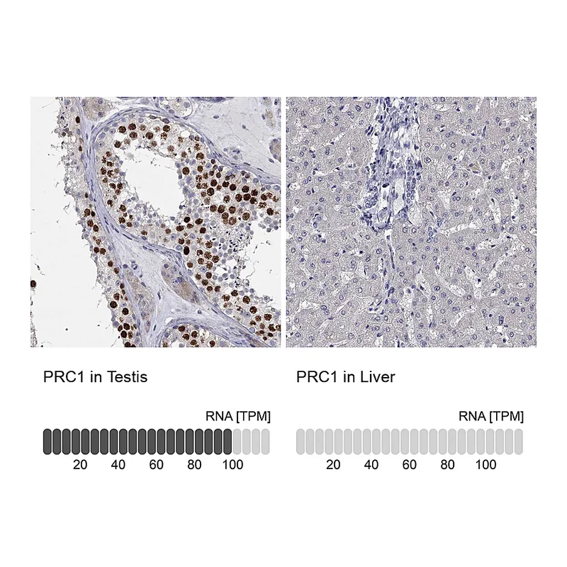 Atlas Antibodies Anti-PRC1 Antibody