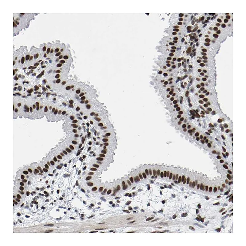 Atlas Antibodies Anti-PRCC Antibody