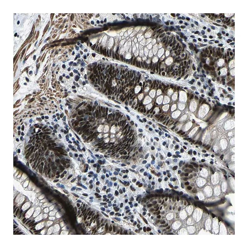 Atlas Antibodies Anti-PRCC Antibody