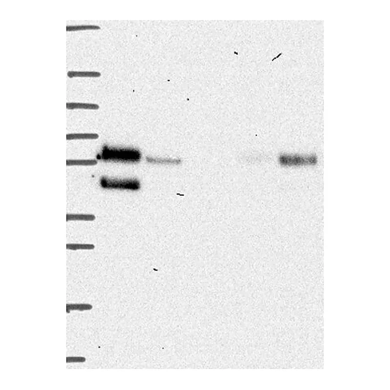 Atlas Antibodies Anti-PRCP Antibody