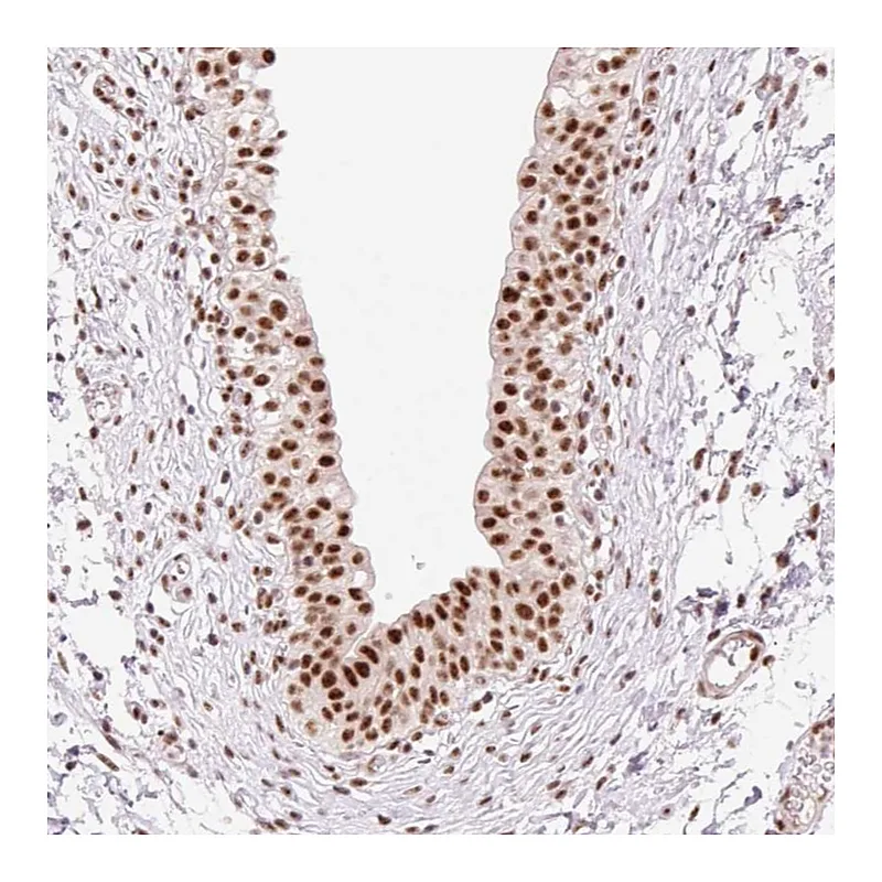 Atlas Antibodies Anti-PRDM11 Antibody