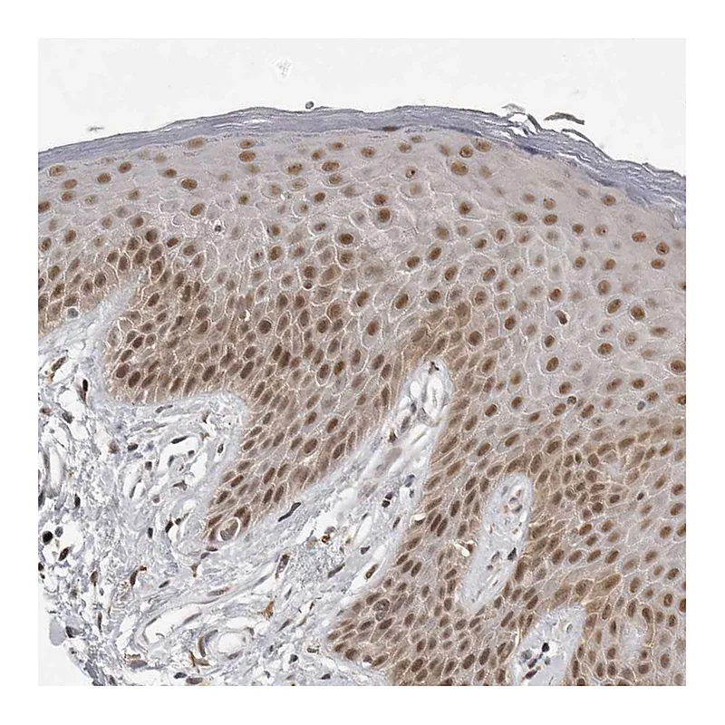 Atlas Antibodies Anti-PRDM10 Antibody