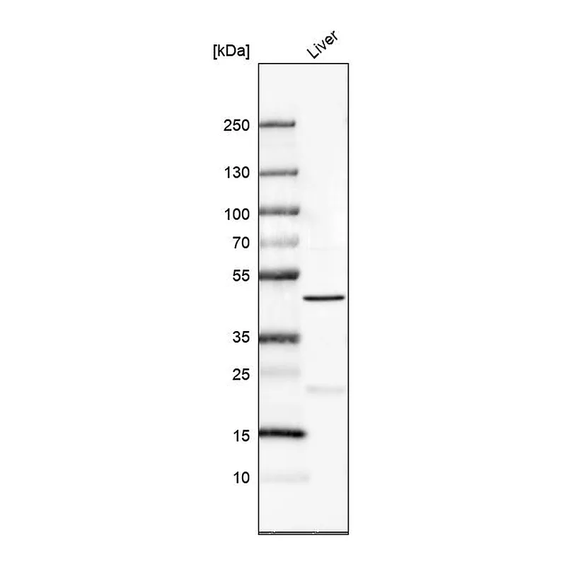 Atlas Antibodies Anti-PRDM12 Antibody