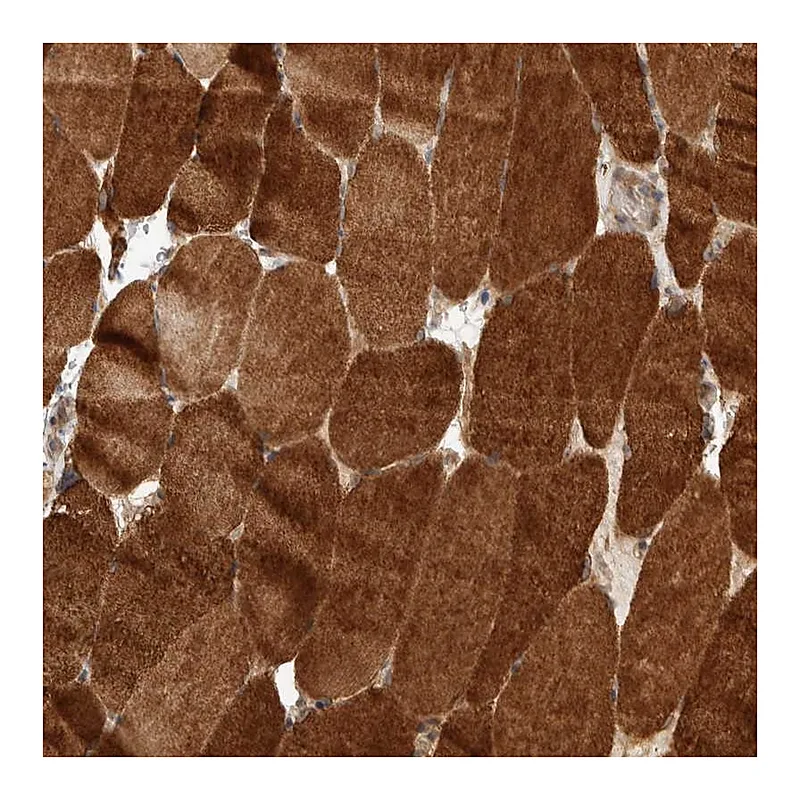 Atlas Antibodies Anti-PRDM15 Antibody