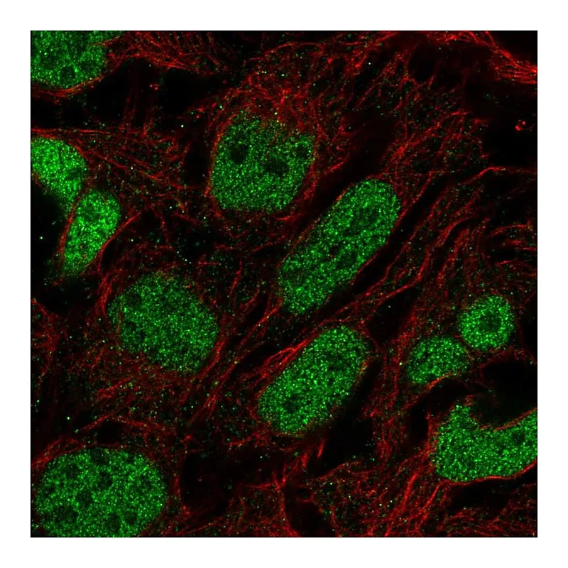Atlas Antibodies Anti-PRDM16 Antibody