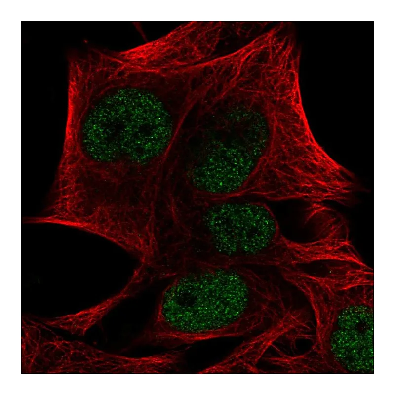 Atlas Antibodies Anti-PRDM4 Antibody