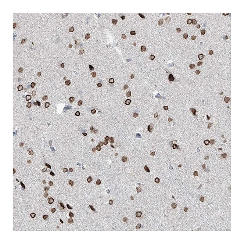 Atlas Antibodies Anti-PRDM6 Antibody