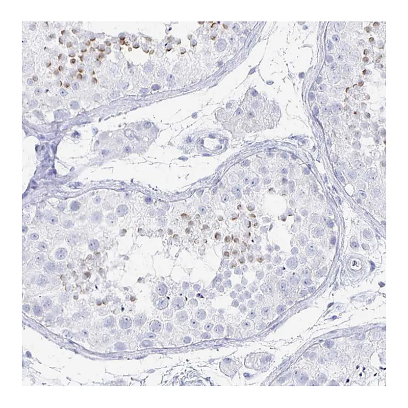 Atlas Antibodies Anti-PRDM7 Antibody