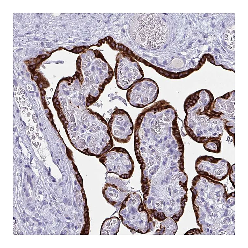 Atlas Antibodies Anti-PRDM9 Antibody
