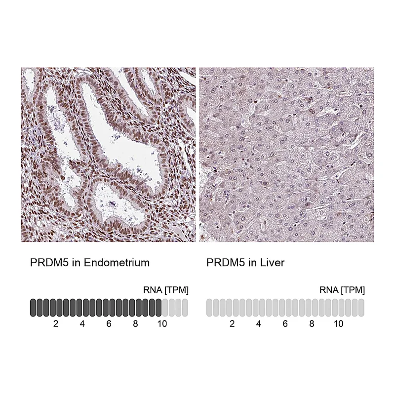 Atlas Antibodies Anti-PRDM5 Antibody