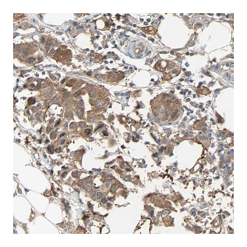 Atlas Antibodies Anti-PRDX1 Antibody