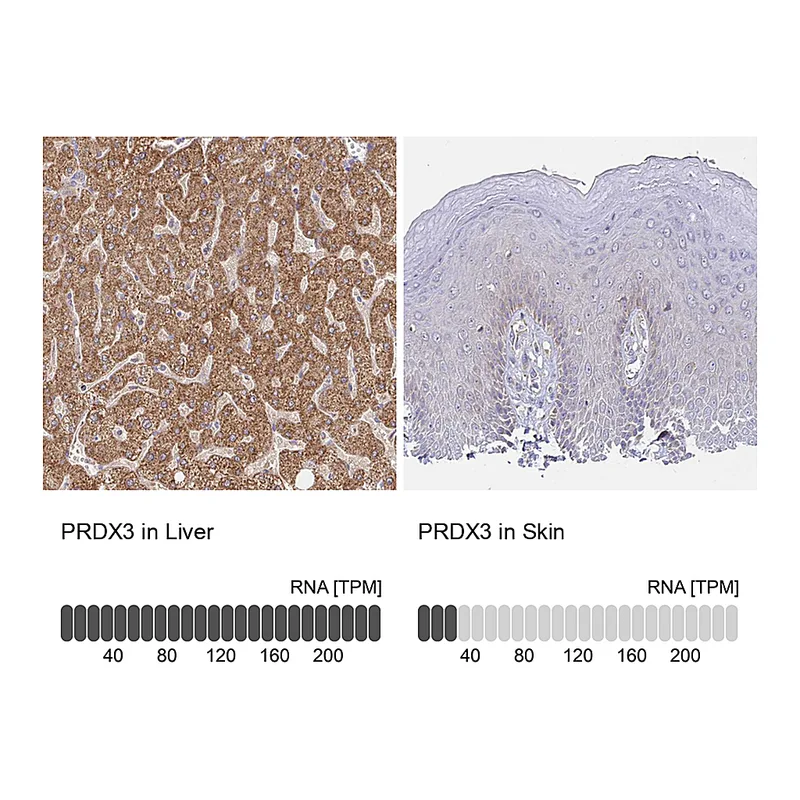 Atlas Antibodies Anti-PRDX3 Antibody