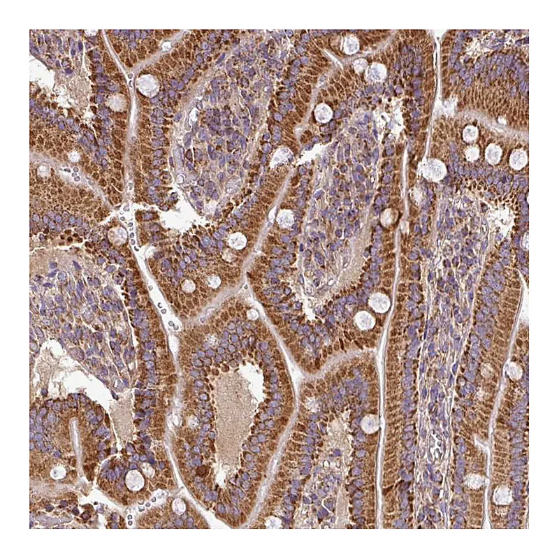 Atlas Antibodies Anti-PRELID3B Antibody