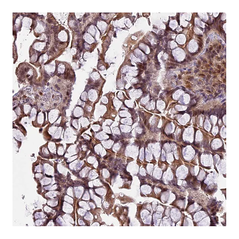 Atlas Antibodies Anti-PRELID2 Antibody