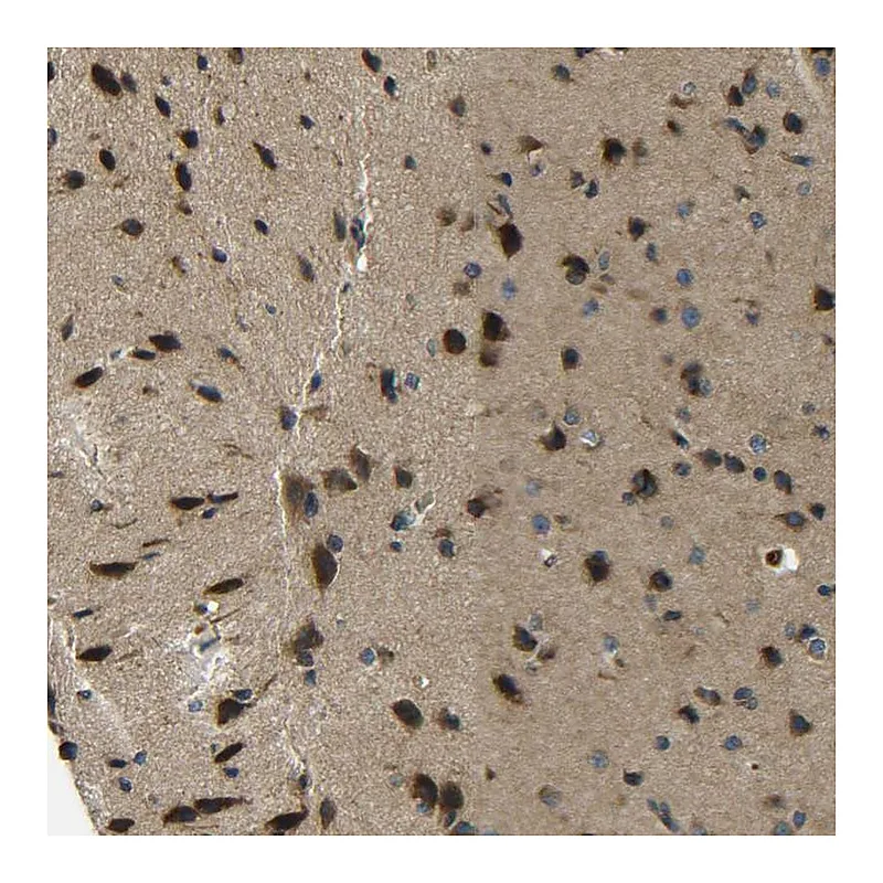 Atlas Antibodies Anti-PREB Antibody