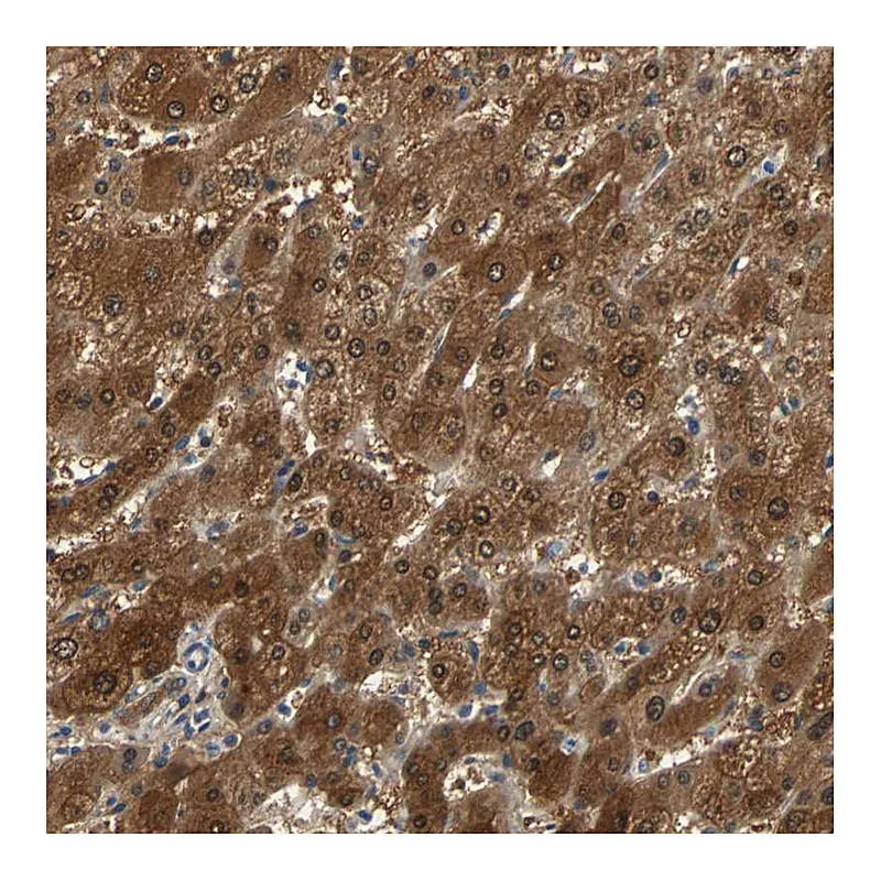 Atlas Antibodies Anti-PRDX6 Antibody