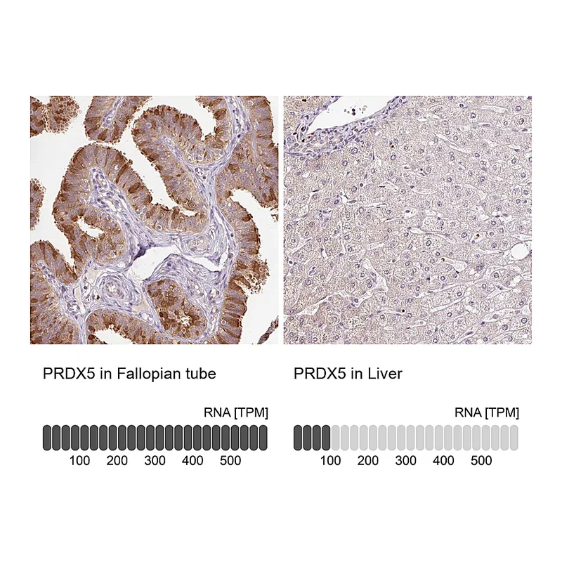 Atlas Antibodies Anti-PRDX5 Antibody