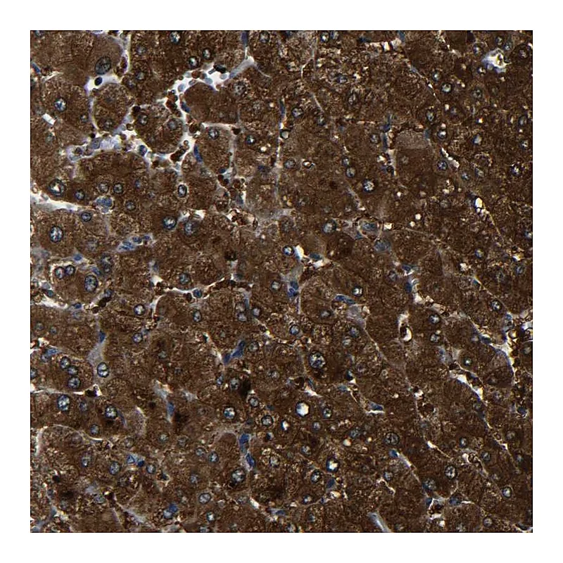 Atlas Antibodies Anti-PREB Antibody