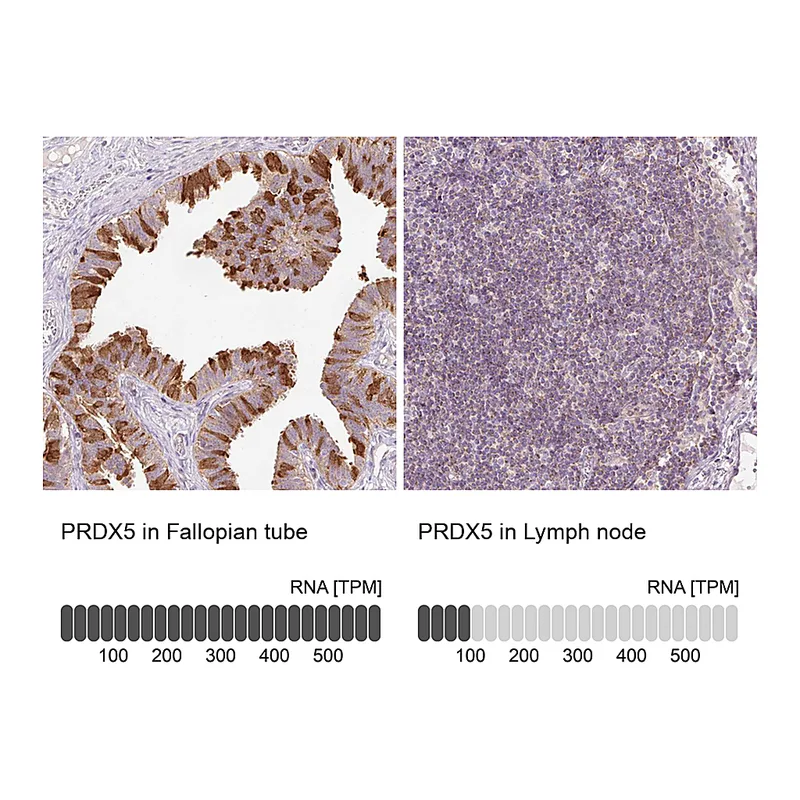 Atlas Antibodies Anti-PRDX5 Antibody