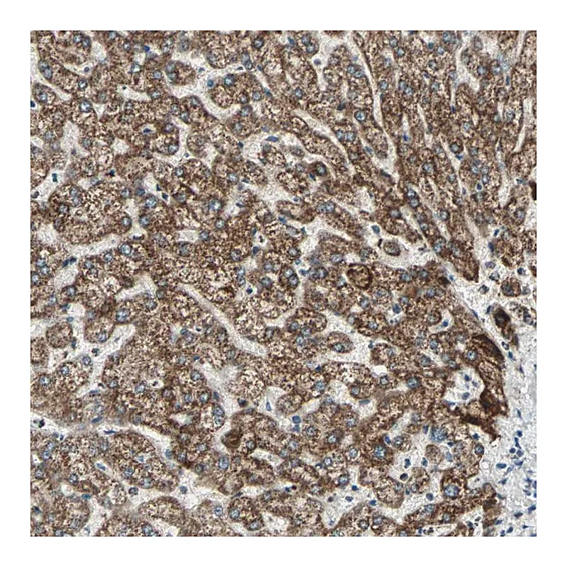 Atlas Antibodies Anti-PRELID1 Antibody