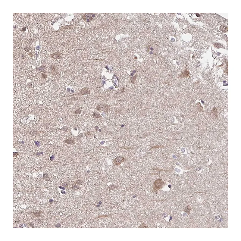 Atlas Antibodies Anti-PREPL Antibody