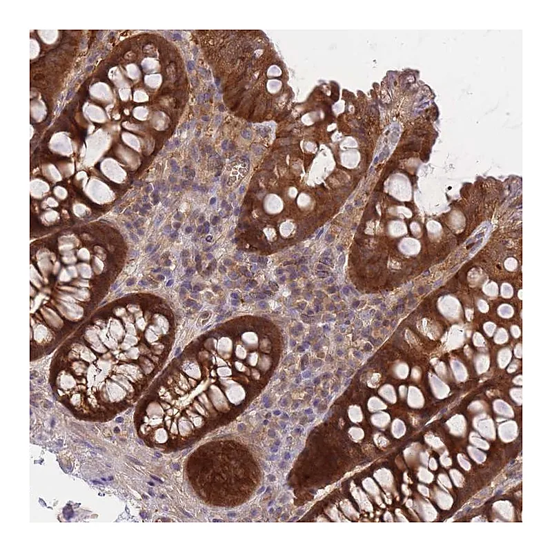 Atlas Antibodies Anti-PREP Antibody
