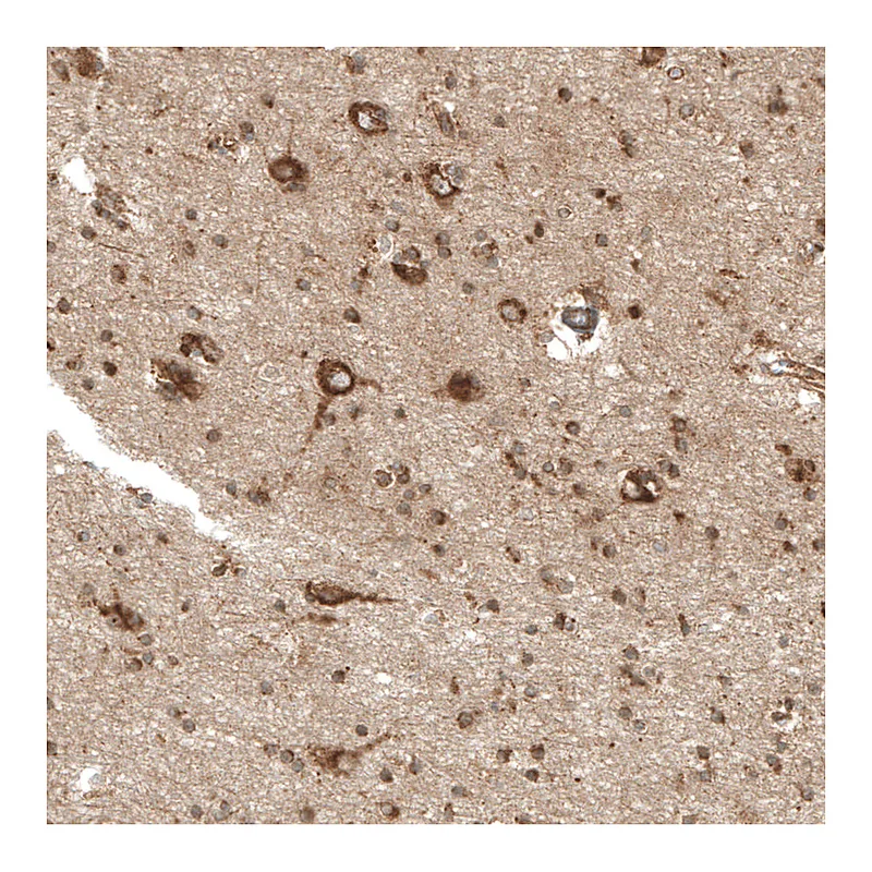 Atlas Antibodies Anti-PREX1 Antibody