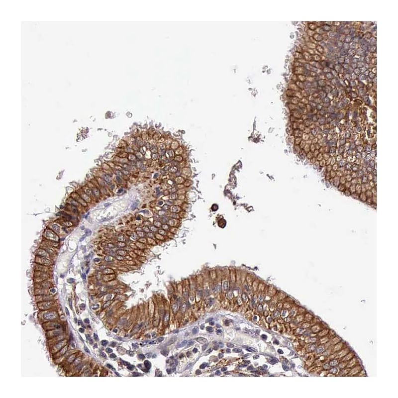 Atlas Antibodies Anti-PRICKLE3 Antibody