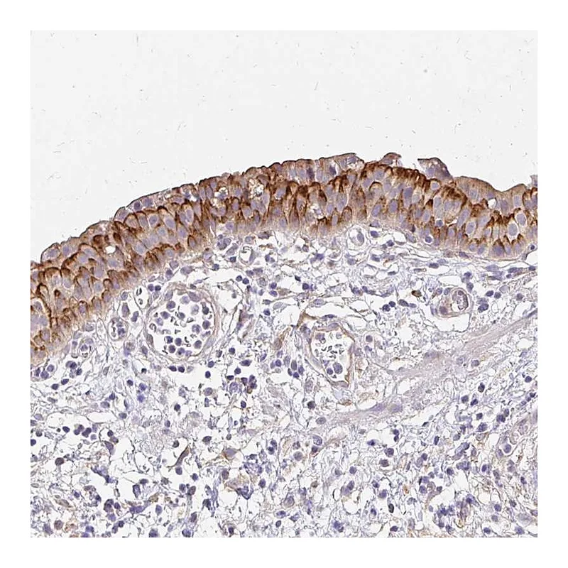 Atlas Antibodies Anti-PRIMA1 Antibody