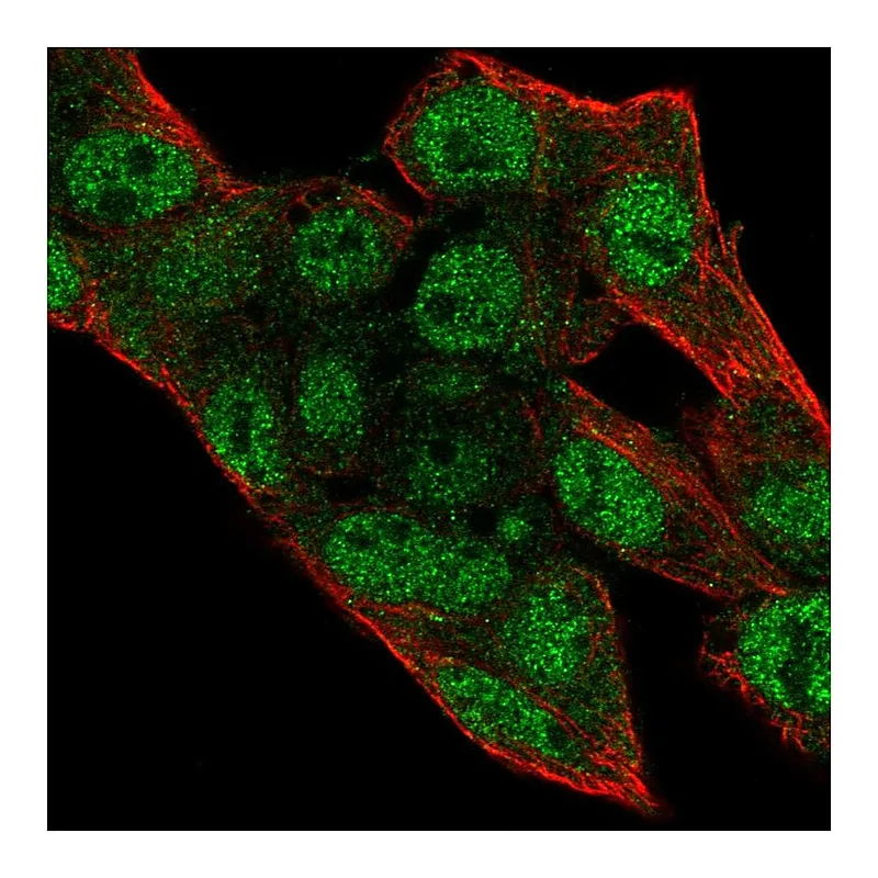 Atlas Antibodies Anti-PRIM2 Antibody