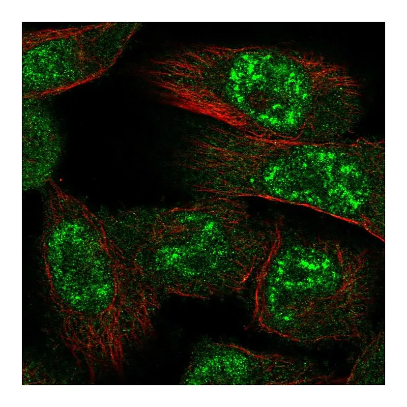 Atlas Antibodies Anti-PRKAA1 Antibody