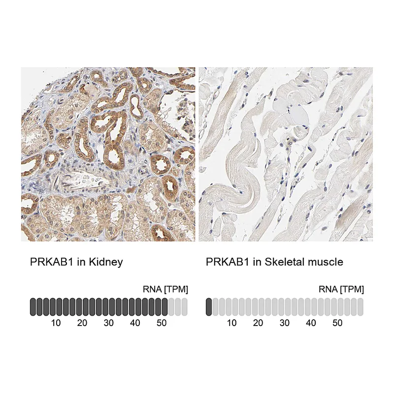 Atlas Antibodies Anti-PRKAB1 Antibody